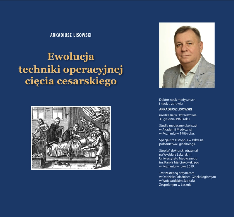 Ewolucja techniki operacyjnej cięcia cesarskiego